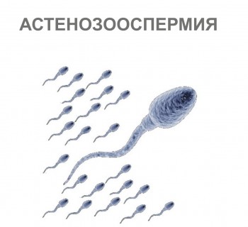 astenozoospermiya-1