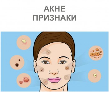 akne-2