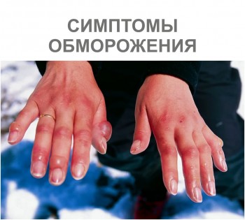 obmorozhenie-2