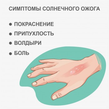 solnechnyj-ozhog-2