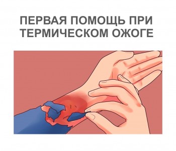 termicheskie-ozhogi-0