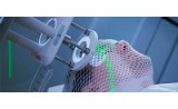 radiation DERMATITIS - фото - 1