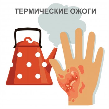 ТЕРМИЧЕСКИЙ ОЖОГ