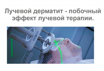 ЛУЧЕВОЙ ДЕРМАТИТ
