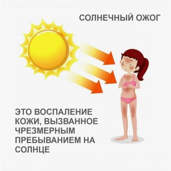 СОЛНЕЧНЫЕ ОЖОГИ: ЧТО ВАЖНО ЗНАТЬ?